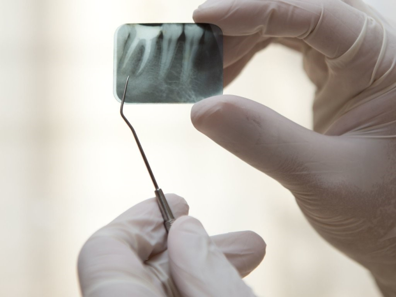 Endodonti